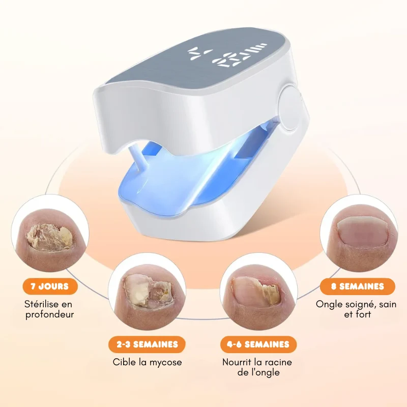 Appareil de traitement au laser pour ongles anti-mycose