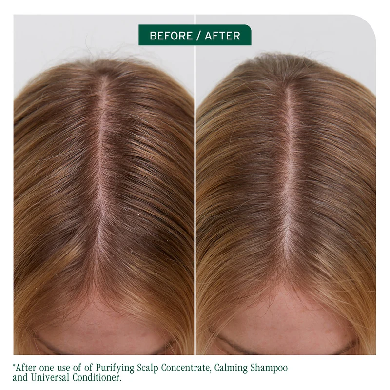 Revitalisant universel "Scalp Sync"