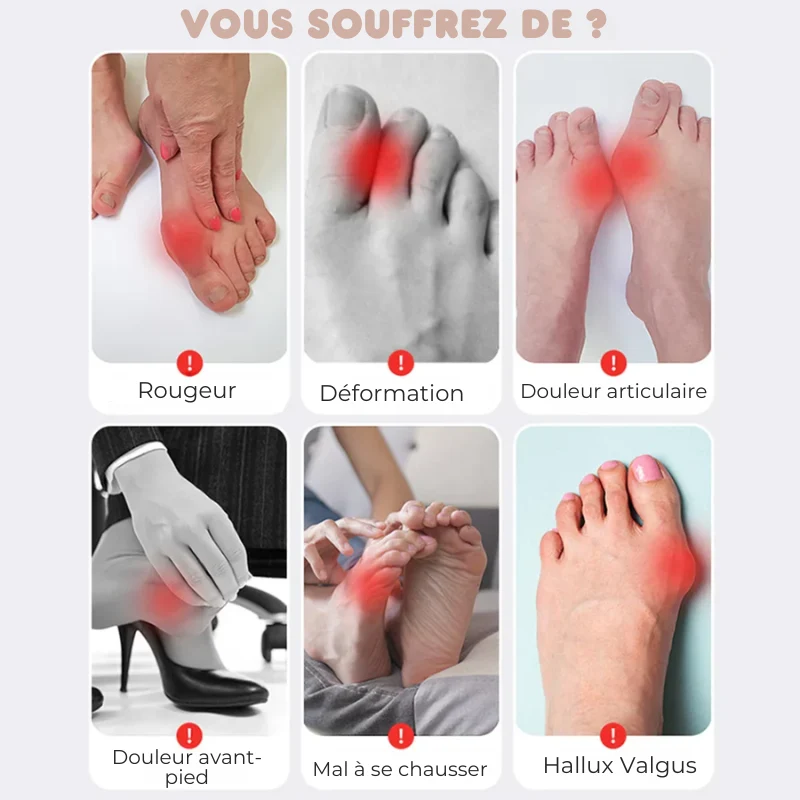 Orthèse Ajustable Hallux Valgus Anti-Douleur
