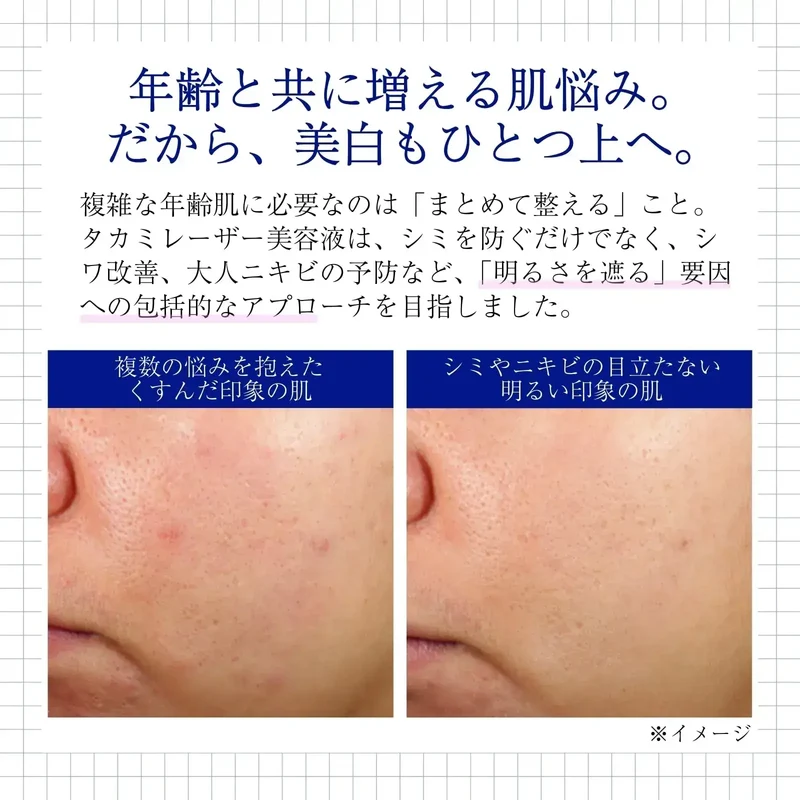 Takami Bright Spot B3+ Whitening Serum - Spots & Wrinkles 30mL