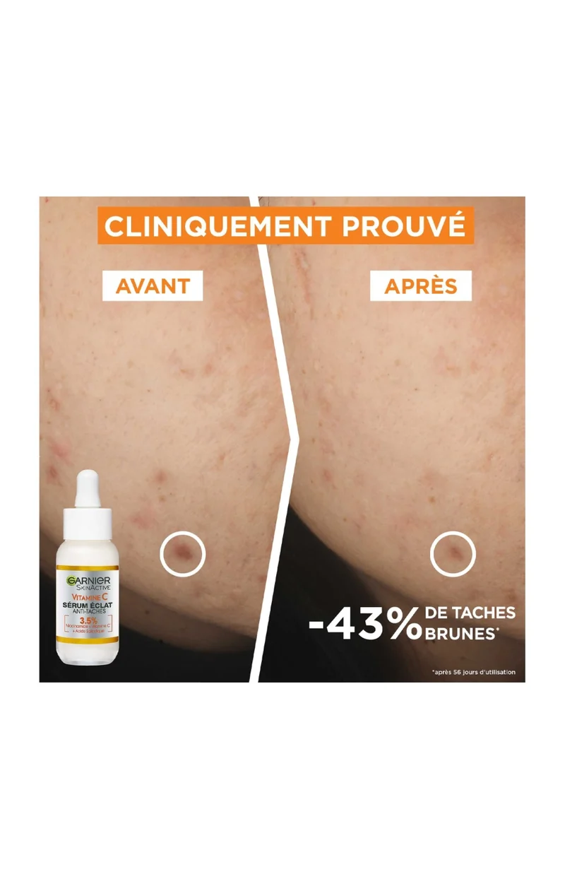 Sérum éclat anti-tâches - Vitamine C - Visage
