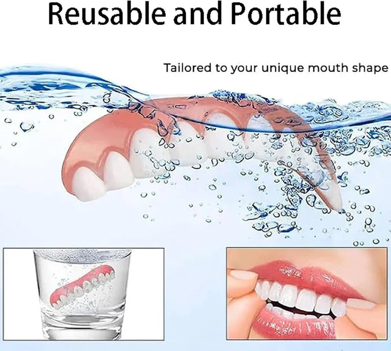 Set di protesi dentali in silicone – Comfort personalizzabile per ogni giorno