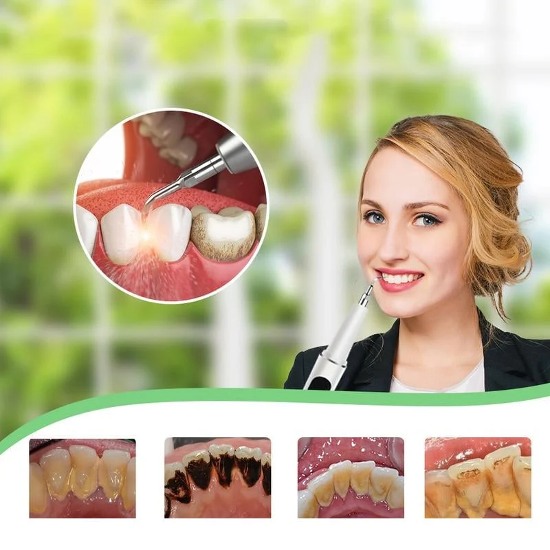 Pulitori Sonici per Denti - Cura Professionale dei Denti a Casa