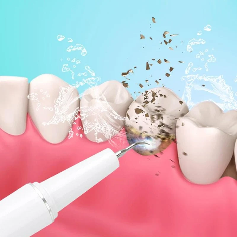 Pulitori Sonici per Denti - Cura Professionale dei Denti a Casa