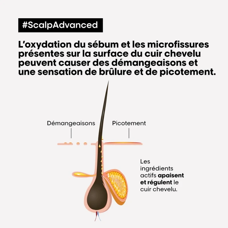 Traitement apaisant intense "Scalp Advanced" (200ml/6.7oz)