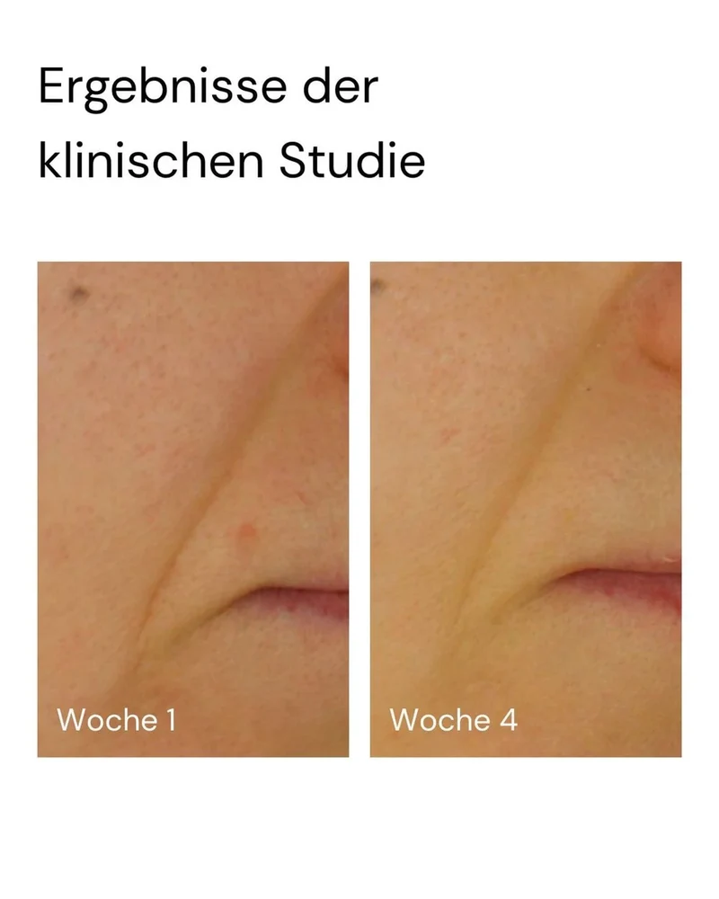 Super Stable C Face Serum 30 ml