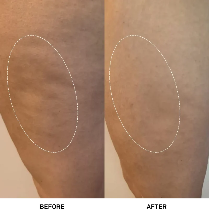 Firming Cellulite Cream 200 ml
