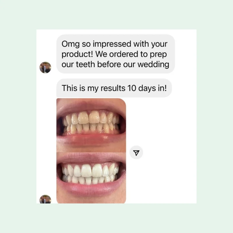 Smilie Boost Teeth Whitening Kit