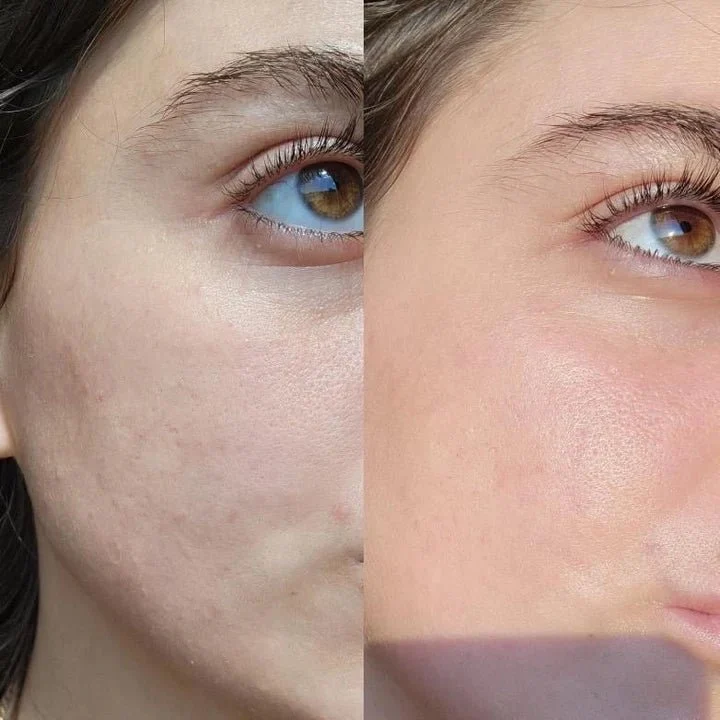 Serum of Clear 30 ml