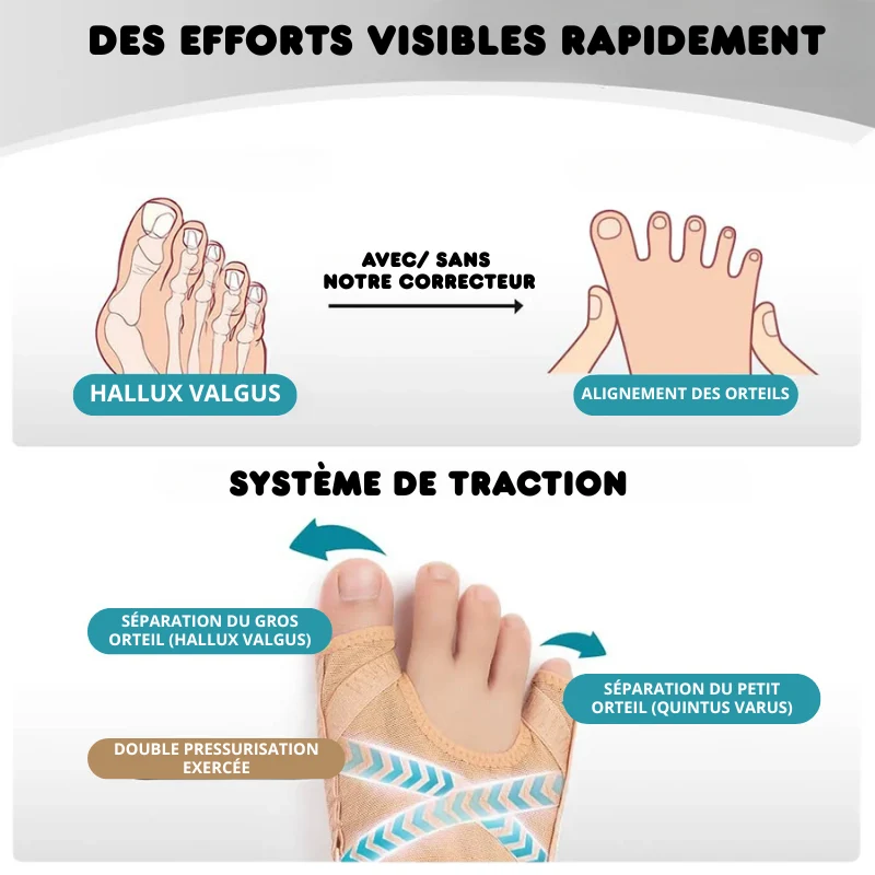 Correcteur d’Oignons Réglable en Tissu Respirant