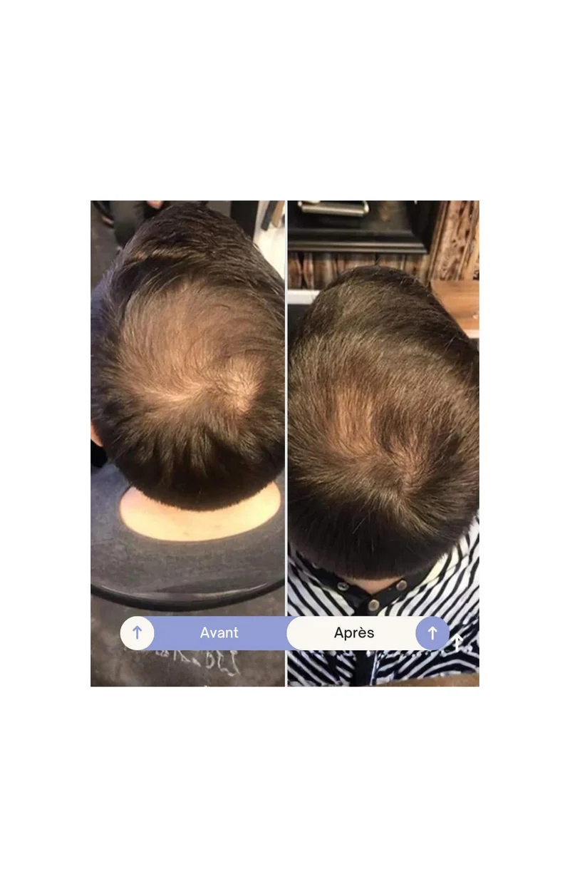 Après-shampoing fortifiant - Grow Perfect - 250 ml