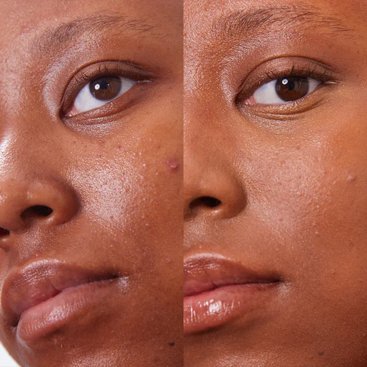 Concealer Balm 5 g