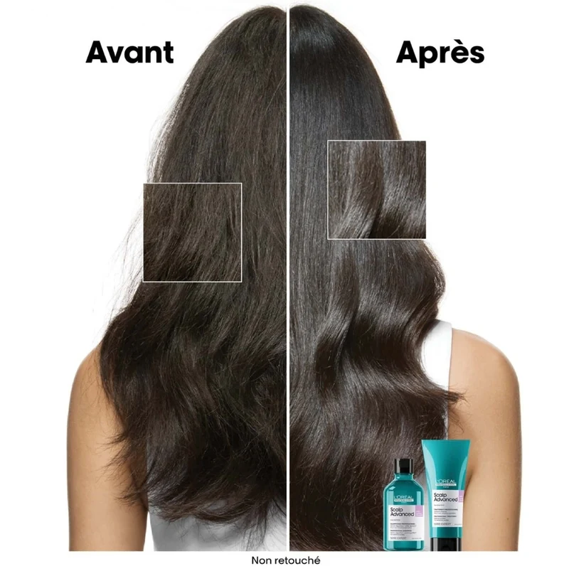 Shampoing anti-inconfort "Scalp Advanced"