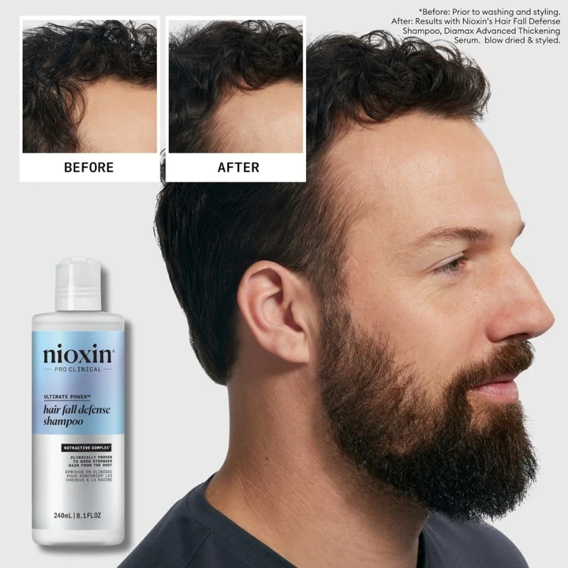 Shampoing anti-chute "Ultimate Power"