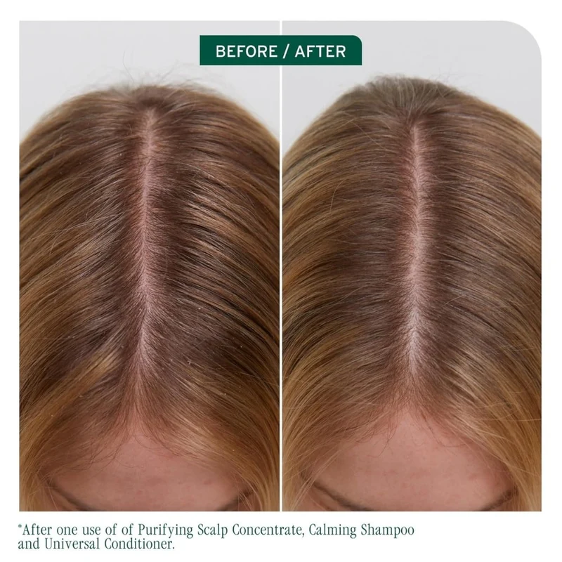 Shampoing calmant apaisant "Scalp Sync"