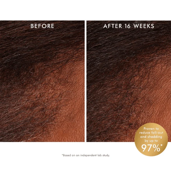 Tonique Revitalisant Cuir Chevelu Scalp