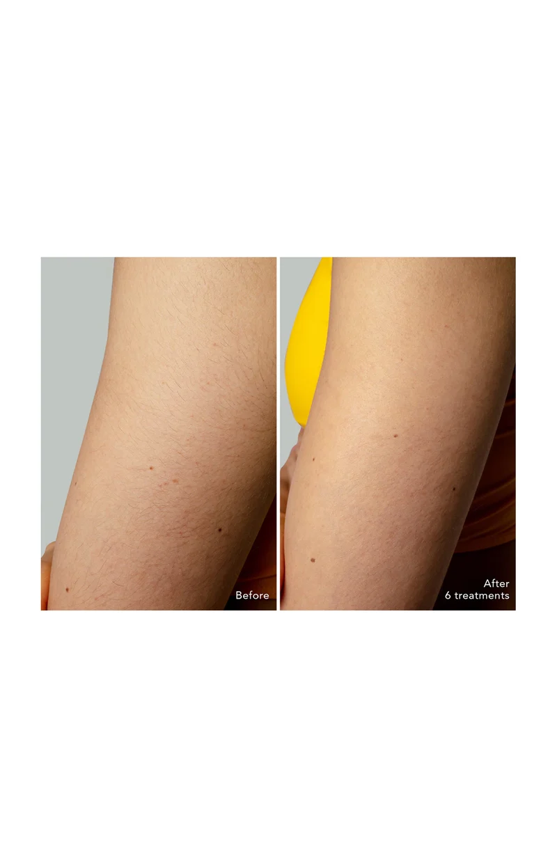 PEACH™ 2 - Appareil d’épilation - Corps & visage - Rose