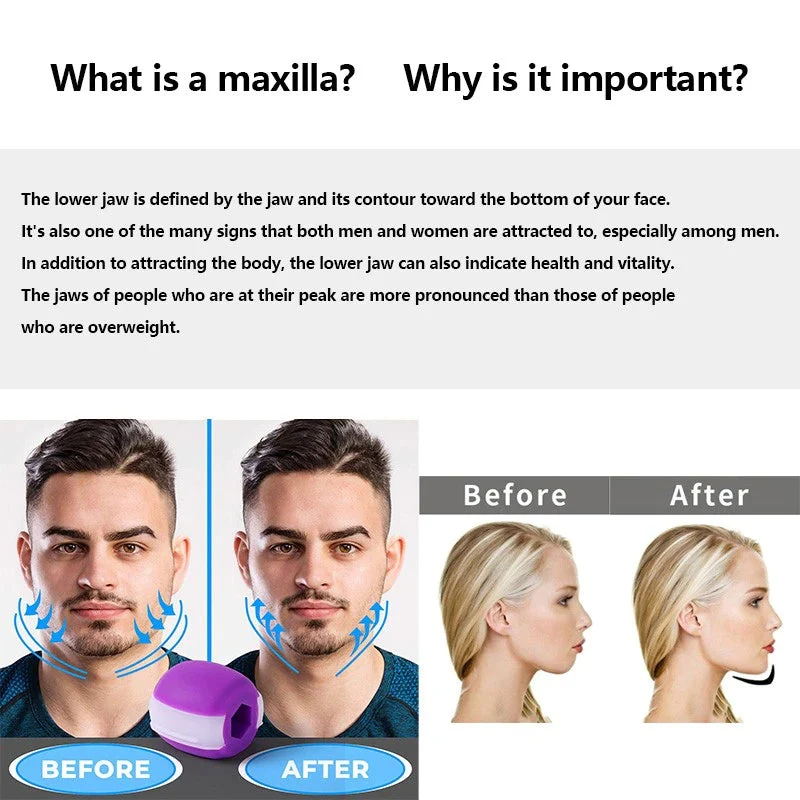 Allenatore per la Mascella – JawSculpt