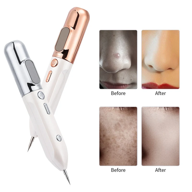 Penna per il Ringiovanimento della Pelle al Plasma - GlowLift