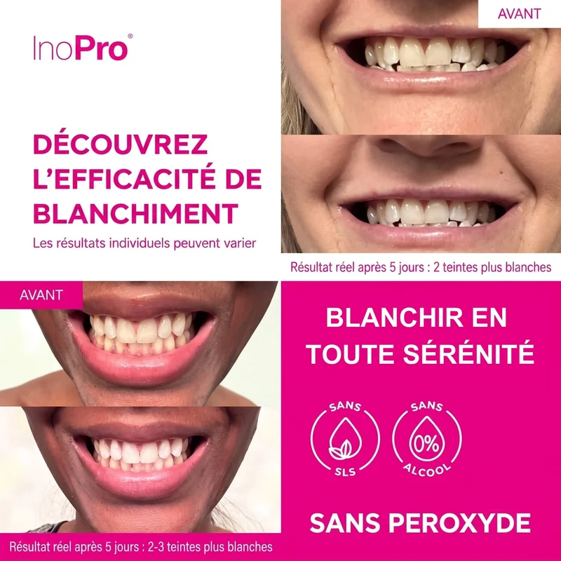 Bandes de blanchiment dentaire - INOPRO INNOVATIVE - 28 bandes
