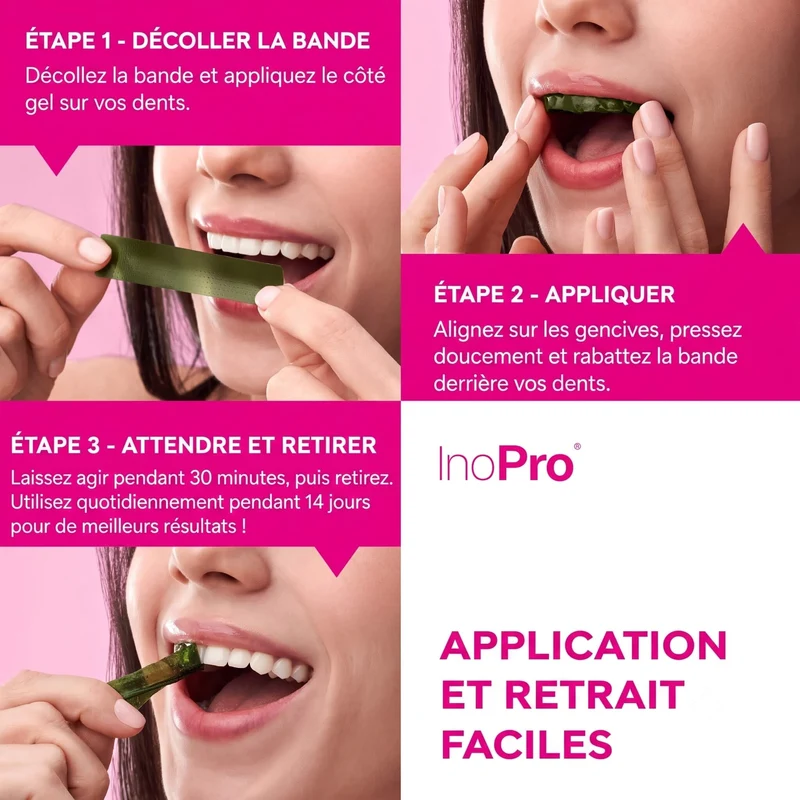 Bandes de blanchiment dentaire - INOPRO INNOVATIVE - 28 bandes