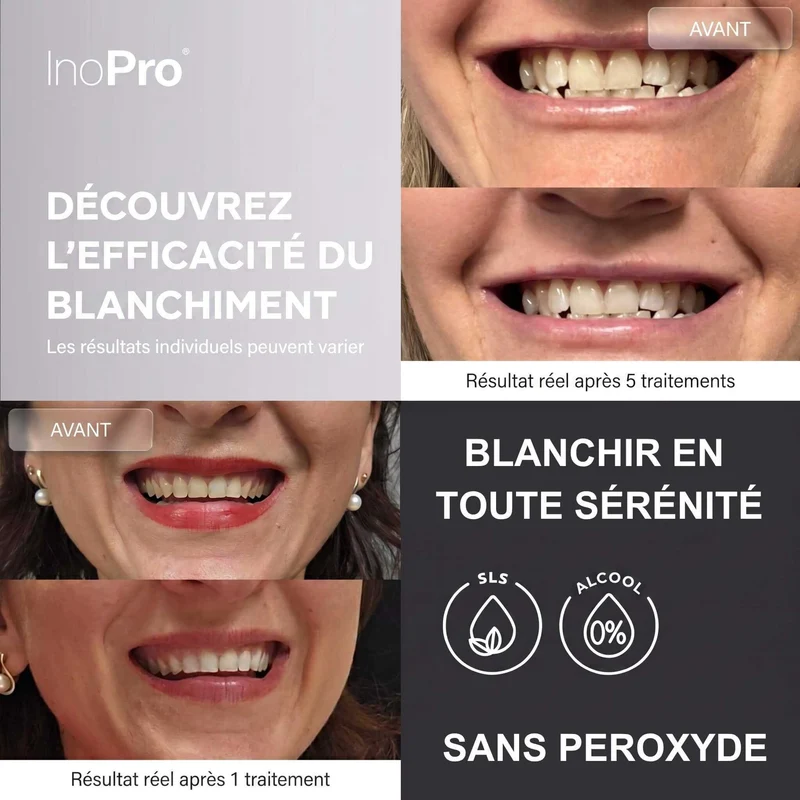 Bandes de blanchiment dentaire - INOPRO ADVANCED - 28 bandes