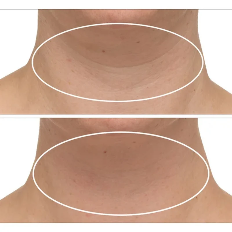 STRIVECTIN - Ensemble de 2 Crèmes Raffermissantes pour le Cou Plus