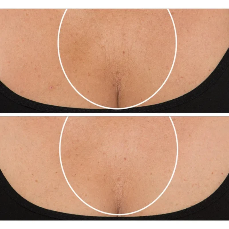 STRIVECTIN - Ensemble de 2 Crèmes Raffermissantes pour le Cou Plus