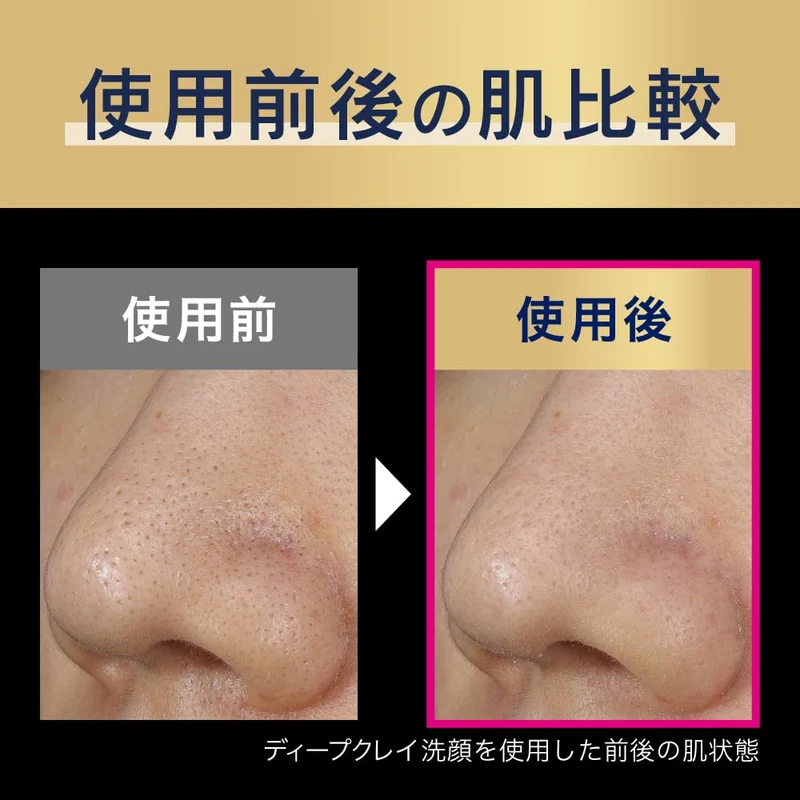 Biore Home de Esthe Deep Clay Face Wash 180ｇ for Pores & Blackheads