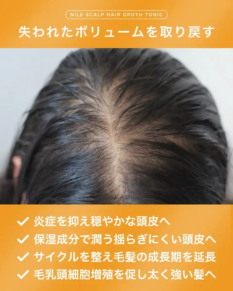 Nile Hair Growth Tonic for Women - Effective Scalp Hair Quasi-Drug Formula