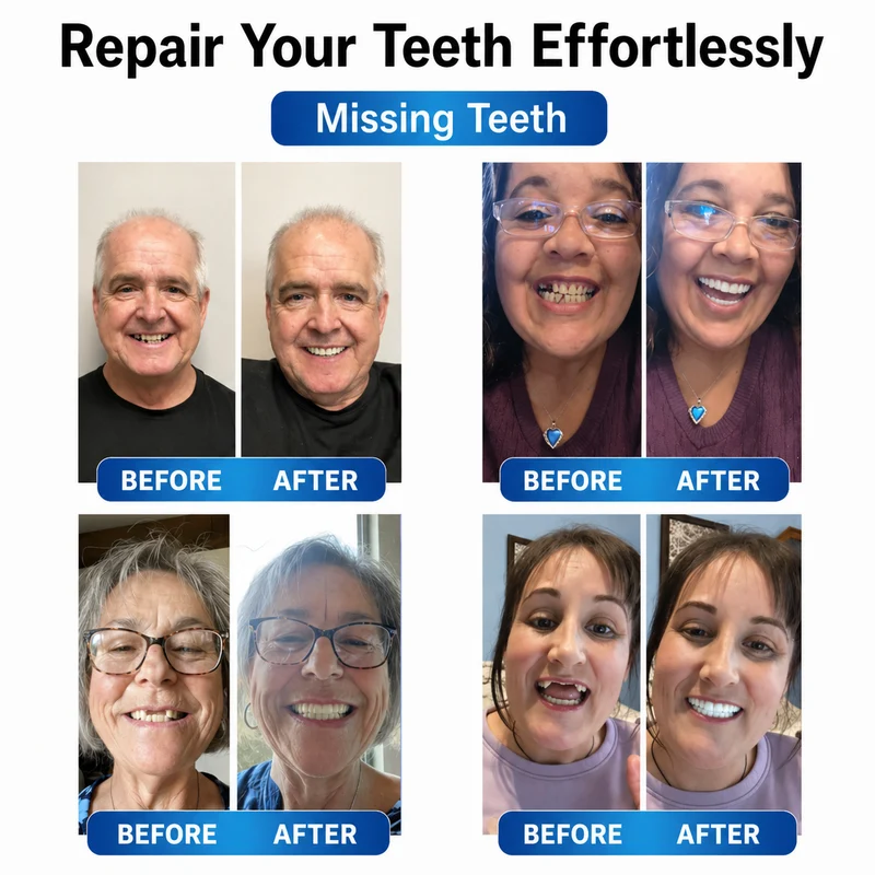Protesi | Set di riparazione dentale con LED | Gel per dentiere modellabile | Futusly