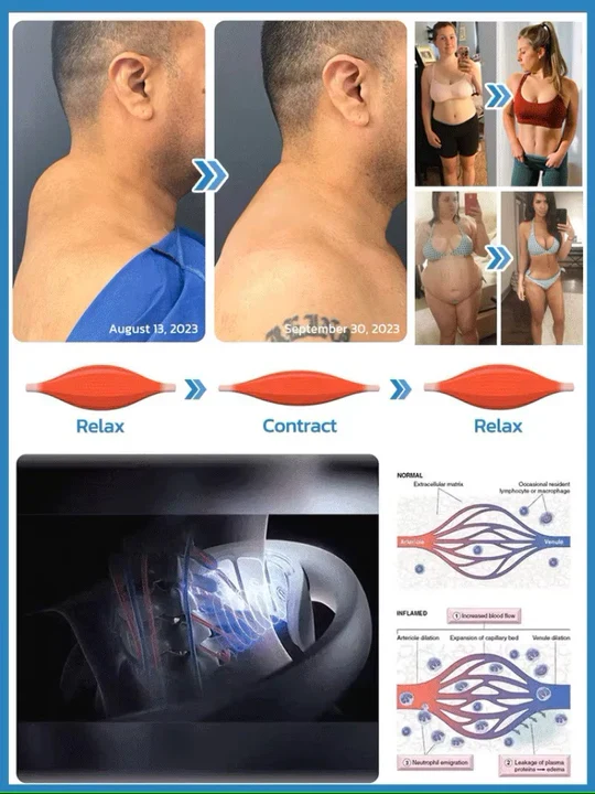 Massaggiatore per il collo | Drenaggio linfatico ad ultrasuoni | Aiuto per massaggi senza fili | Vitalize