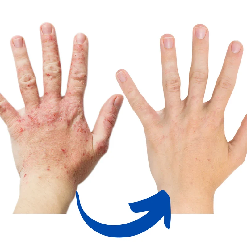 Guanti per Terapia Infrarossa ArthroGlow per il Sollievo dal Dolore Artritico