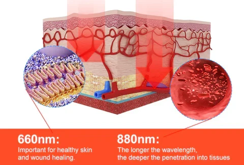 Guanti per Terapia Infrarossa ArthroGlow per il Sollievo dal Dolore Artritico