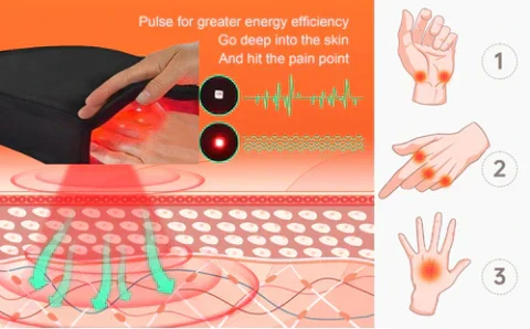 Guanti per Terapia Infrarossa ArthroGlow per il Sollievo dal Dolore Artritico