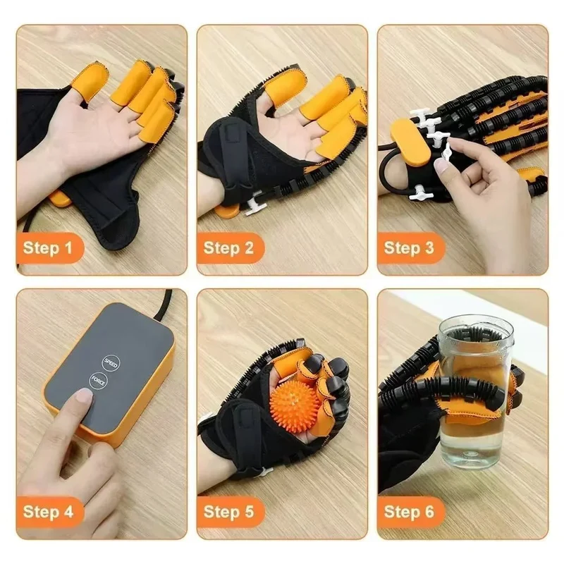 MOTORAFLEX – Guanto riabilitativo automatico per riabilitazione domestica e potenziamento muscolare