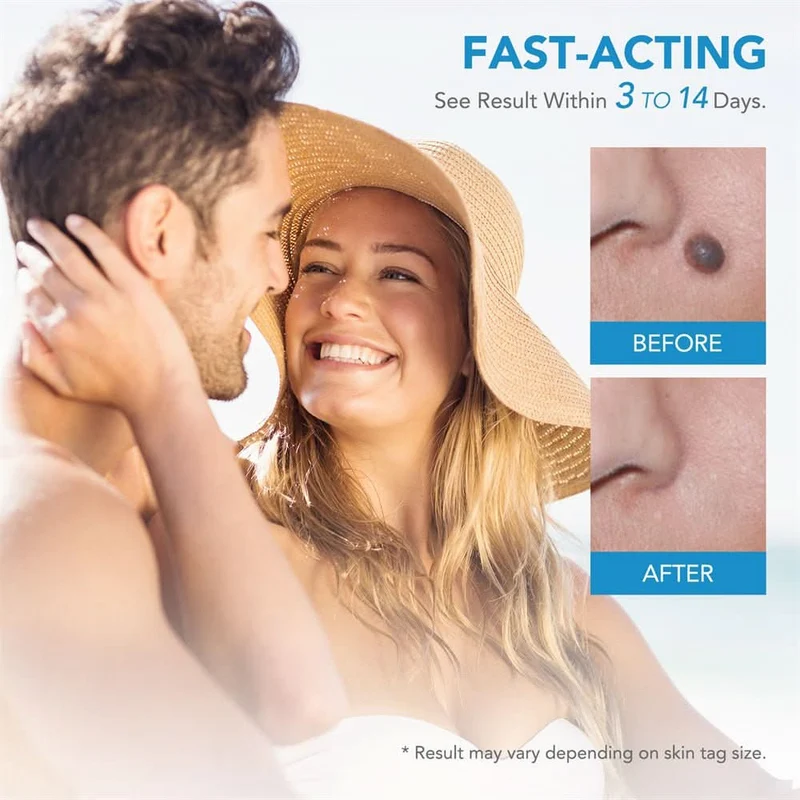 Dermaswift – Rimuovi Macchie Cutanee Contro Verruche e Escrescenze Cutanee