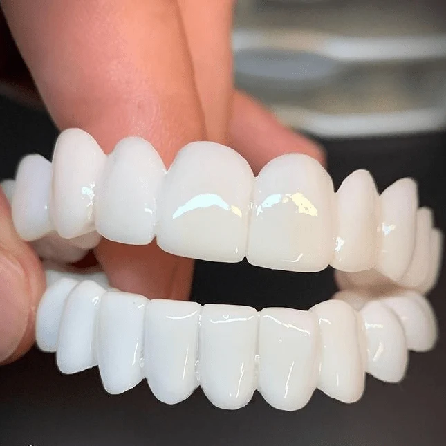 SmileFlex – Protesi dentale personalizzabile con lenti dentali