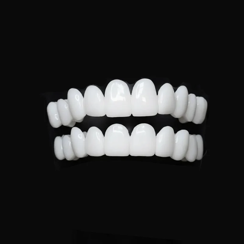 SmileFlex – Protesi dentale personalizzabile con lenti dentali