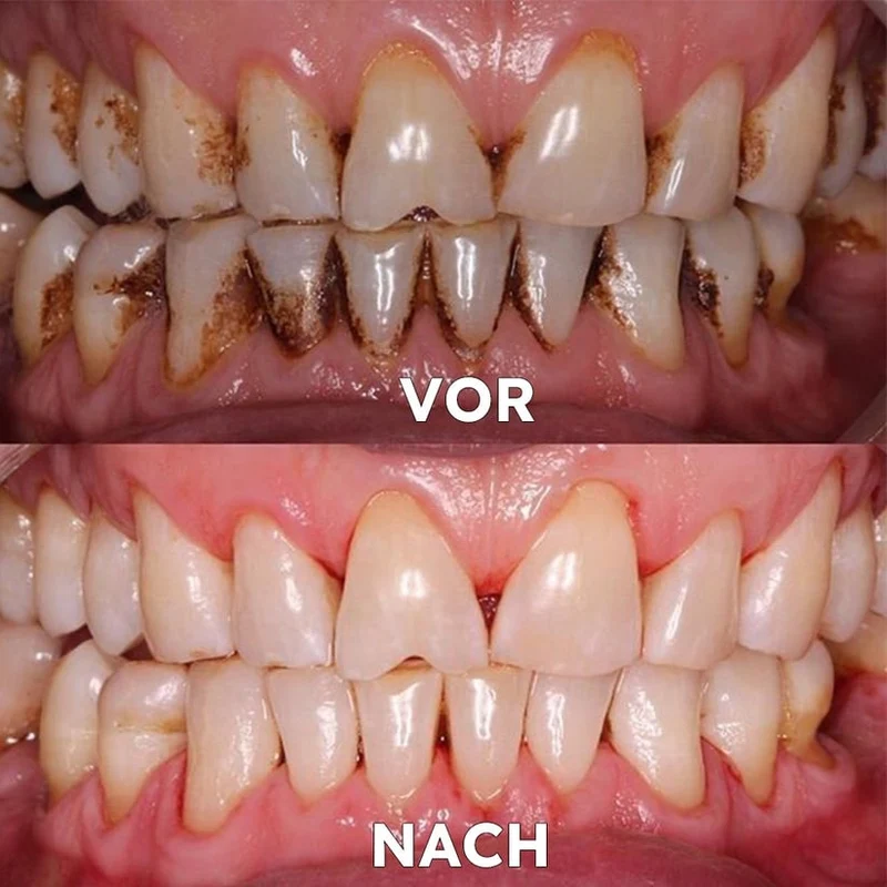 Polvere minerale per la cura dei denti | Rinforza e protegge i denti | SmileSchutz