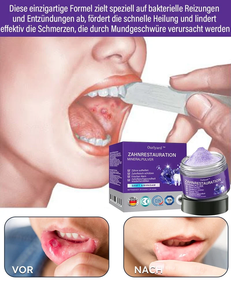 Polvere minerale per la cura dei denti | Rinforza e protegge i denti | SmileSchutz