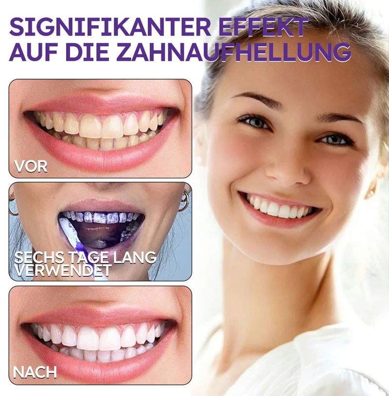 Polvere minerale per la cura dei denti | Rinforza e protegge i denti | SmileSchutz