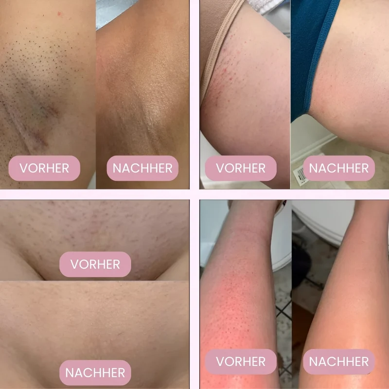 Rasoi per la zona intima per donne | Rasoio elettrico per donne per la zona intima | Trimmer per bikini | Femora