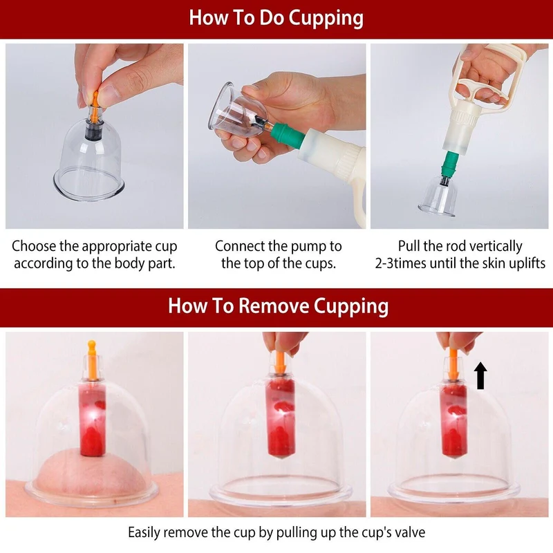 CuppingThera Pro | Set di Terapia con Ventose da 32 Pezzi per Massaggio e Agopuntura