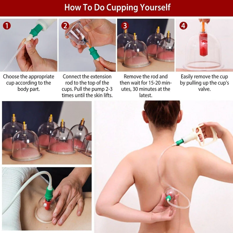 CuppingThera Pro | Set di Terapia con Ventose da 32 Pezzi per Massaggio e Agopuntura