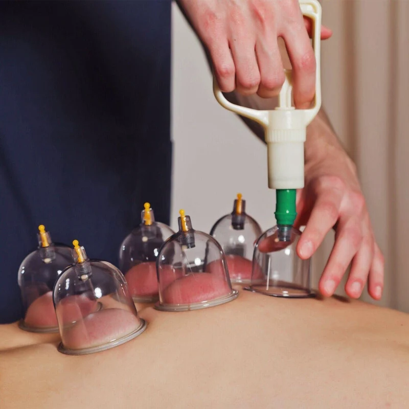 CuppingThera Pro | Set di Terapia con Ventose da 32 Pezzi per Massaggio e Agopuntura