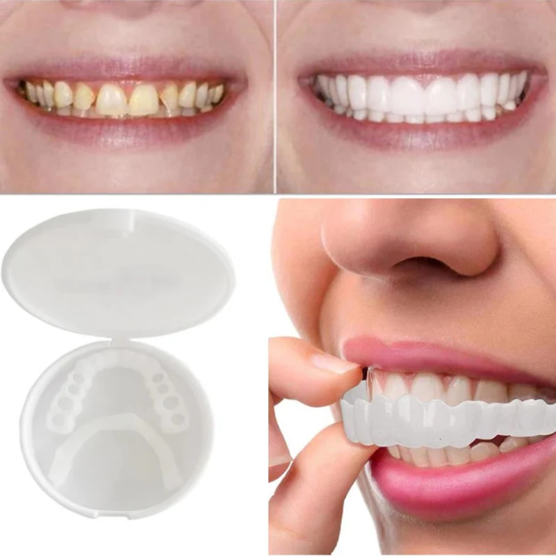 SmilePro | Soluzione per Protesi Dentale Flessibile e Confortevole Immediata