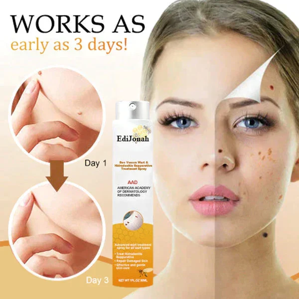 SkinClear | Spray Rimuovi Verri – Trattamento Delicato ed Efficace