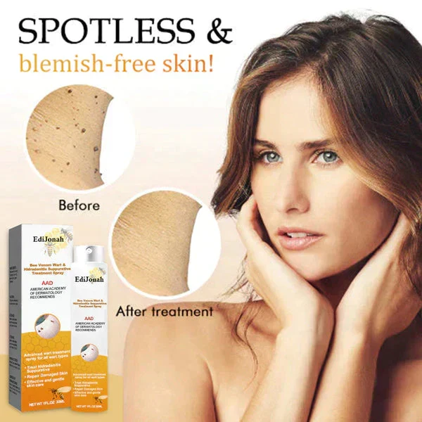 SkinClear | Spray Rimuovi Verri – Trattamento Delicato ed Efficace