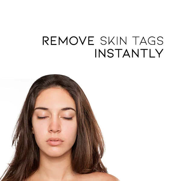 SkinClear | Spray Rimuovi Verri – Trattamento Delicato ed Efficace